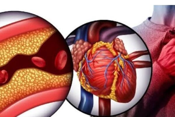 नाचते और व्यायाम करते कैसे मौत हो जाती है, जानिए?